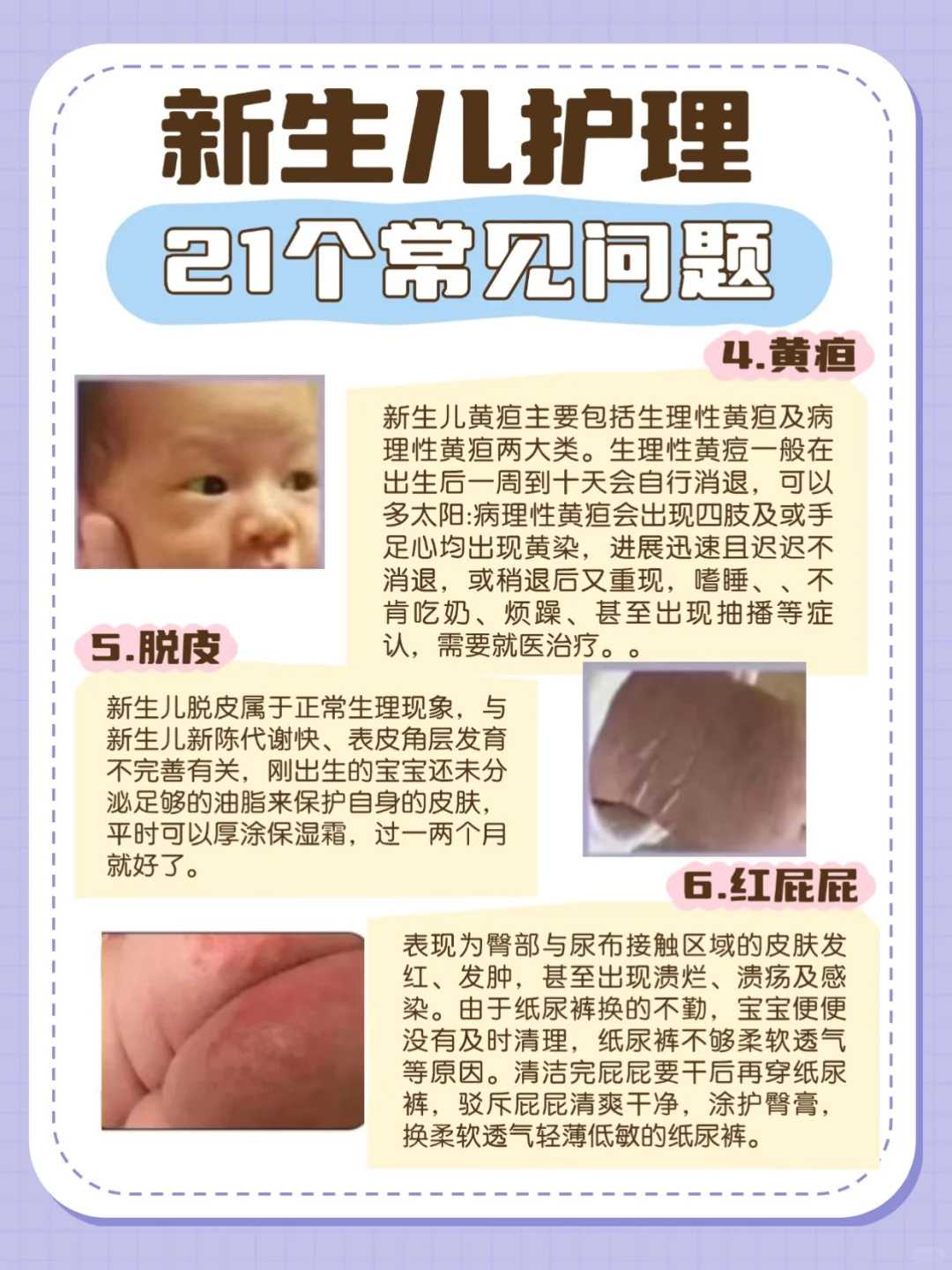 南京供卵试管婴儿适合哪些人 三大医学指征盘点